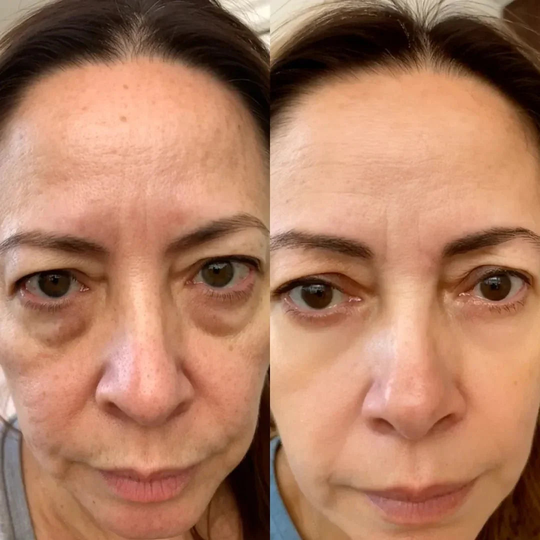 Anti-Aging EMS & Red Light Therapy Eye Glasses